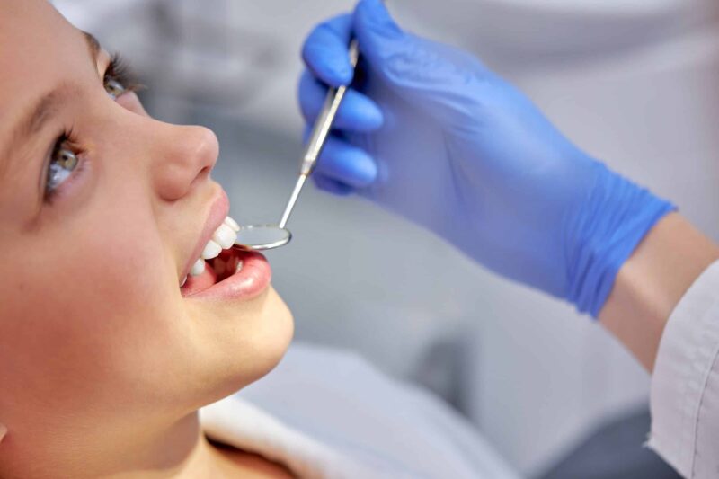 dental sealants for children